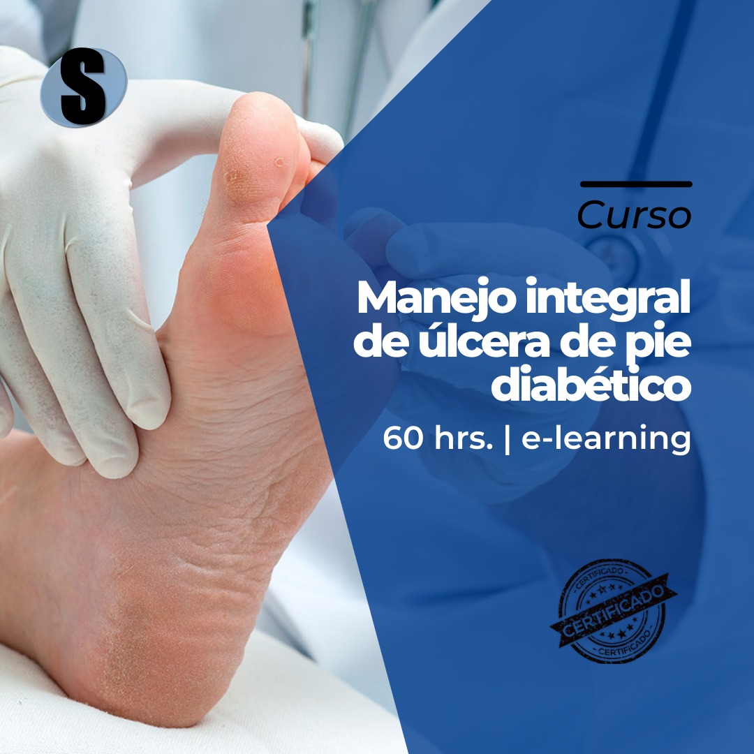 Curso Manejo integral de úlcera de pie diabético 60 hrs. Seprotec